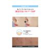 G9SKIN Zero Solution Spot Cover Patch (1 Piece x 36 Sheets) / Zero Solution Spot Cover Patch (36 Sheets)