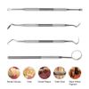 Plaque Remover for Teeth - Tartar Remover for Teeth, Dental Calculus Remover Set