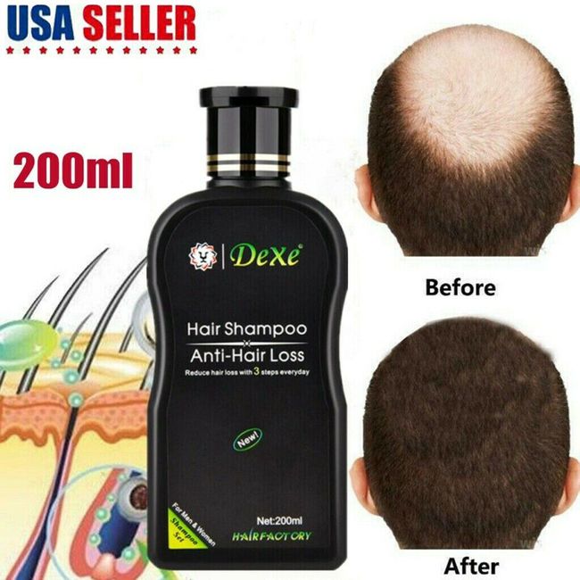 Dexe Original Anti-Hair Loss Shampoo Natural Herbal Hair Growth Treatment 200ml