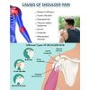 Wonder Care-Left Right Shoulder Immobilizer Arm Sling Elastic Brace for Clavicle Collar Bone Dislocation Subluxation Shoulder stabilizer Compression Brace After Rotator Cuff Surgery - Black-Size 3