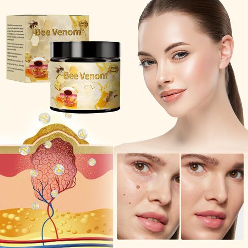Bee Venom Cream, New Bee Venom Skin Treatment Cream, Professional Natural Bee Venom Repair Cream Gel, Bee Venom Skin Cream for All Parts of The Body (1 Pack)