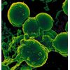 Immune support probiotic - CANDIDA AWAY 1275MG  1B - candida cleaner