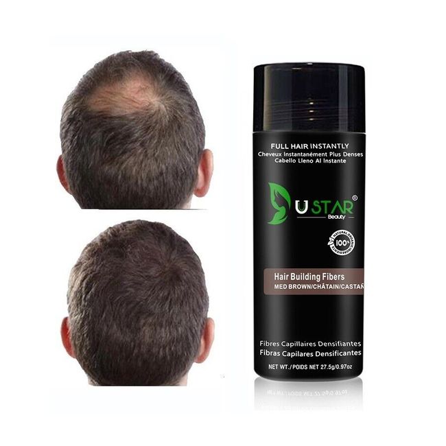 Hair Loss Concealer Medium Brown Ustar Hair Fibers 0.97oz FREE SHIP